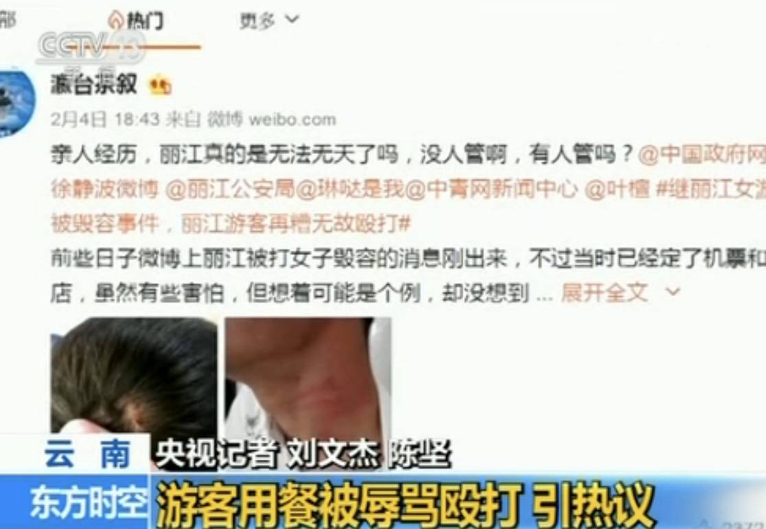 最新揭秘：脱发现象追踪报道，热点新闻一网打尽